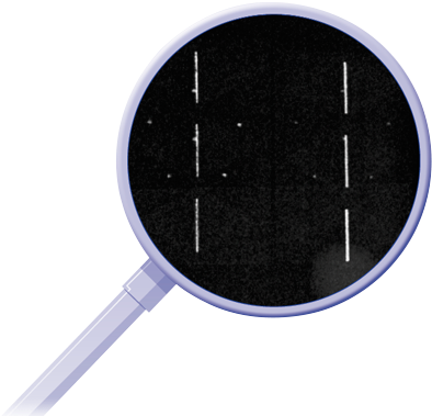 What Is Your Mammography Skin Marker Hiding From You - Blog (625x391), Png Download