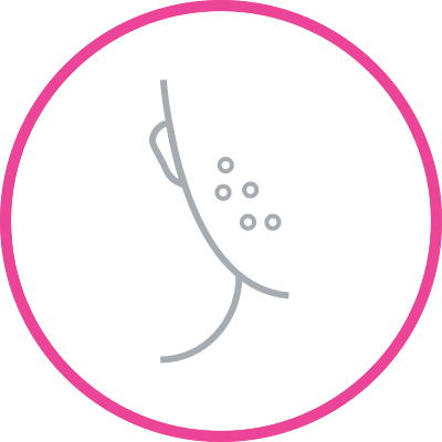 Acne Solutions - Rejuvenation (400x400), Png Download