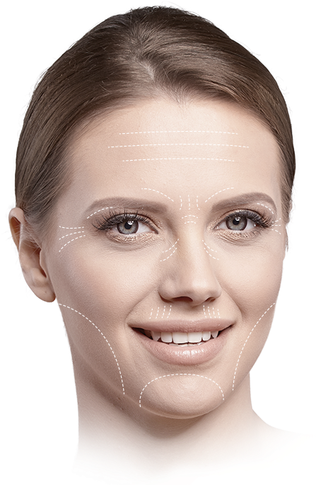 Vertical Lip Lines - Lip Therapy With Filler In Australia (480x695), Png Download