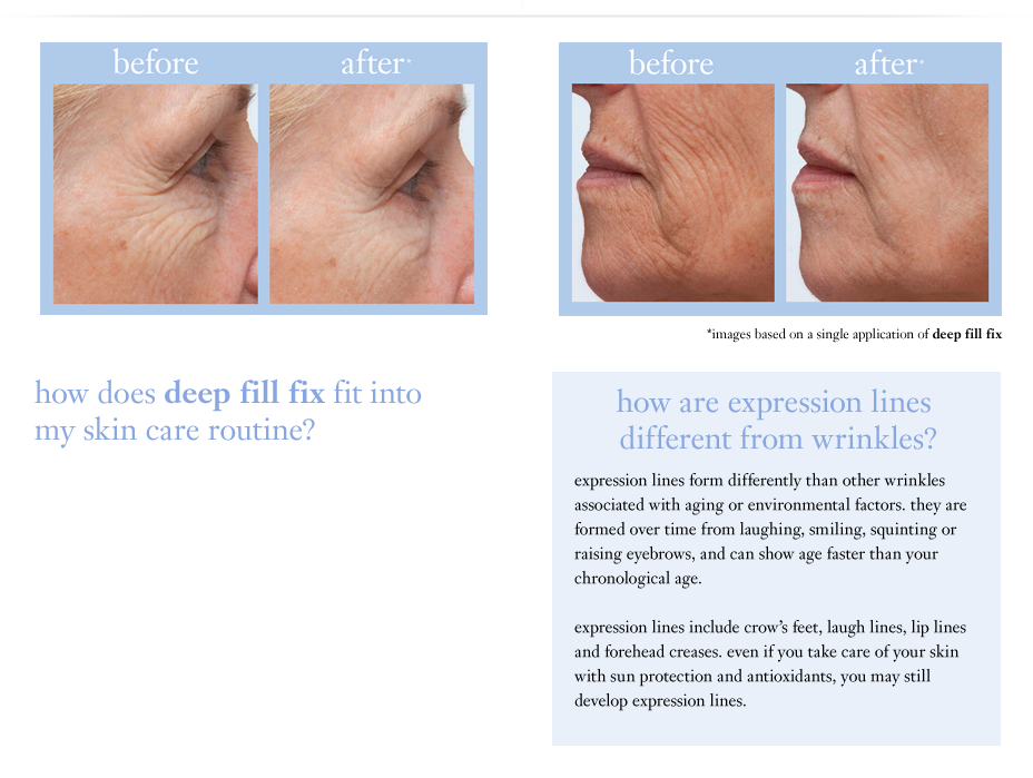 Apply Directly To Deep Wrinkle Areas Such As The Outer - Senior Citizen (928x699), Png Download
