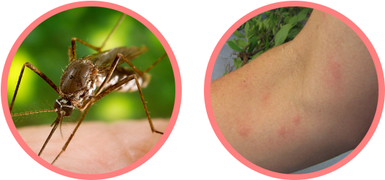 Mosquitoes Teeny, Tiny, Silent Disease-carriers - Mosquito (640x300), Png Download