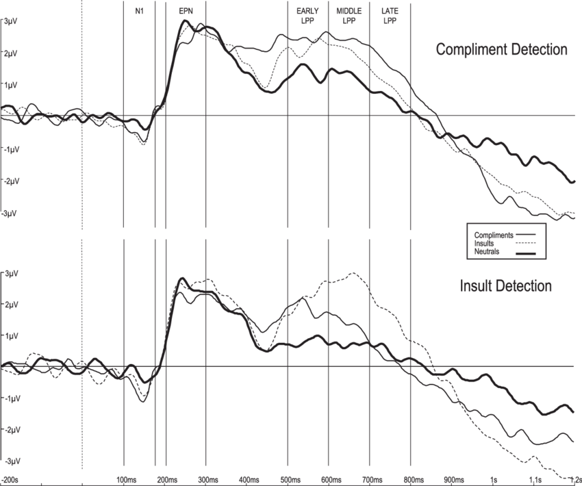 Waveforms From Electrode Cpz Depicting Compliments - Diagram (850x710), Png Download