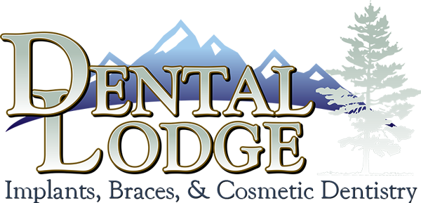 The Dental Lodge Of Noble - Dental Implant (600x289), Png Download