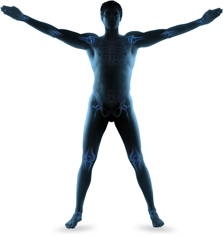 Enhancement Slipped Disc Patellar Tendinopathy Impingement - Human Silhouette Wide Arms Png (727x766), Png Download