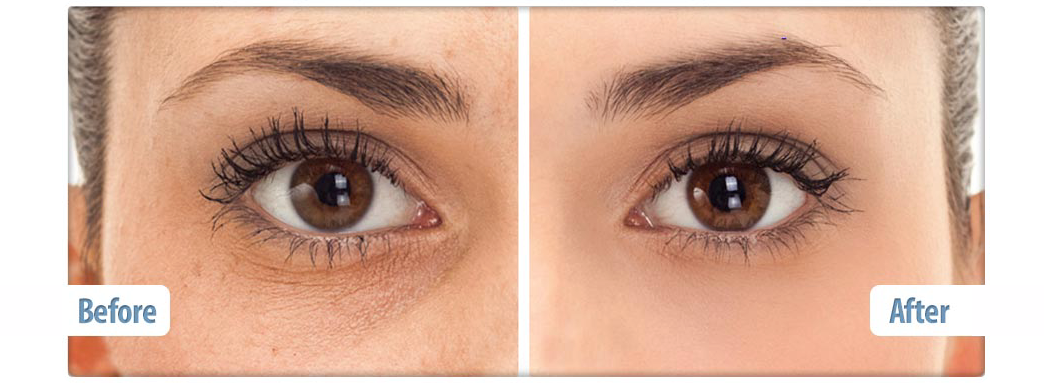 firm it up eye serum