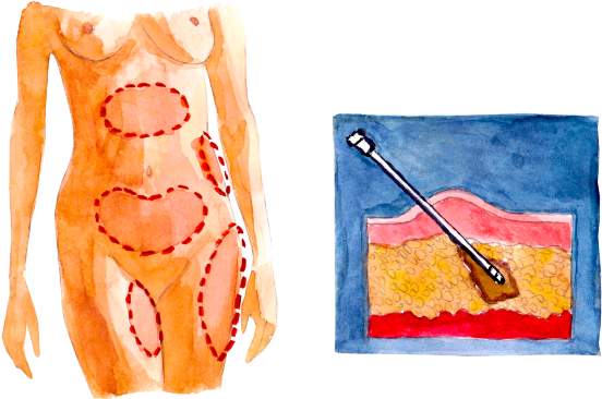 Viksraitis (659x480), Png Download