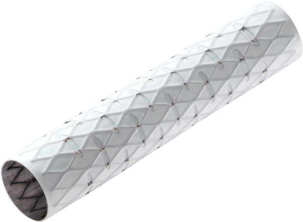 Endovascular Stents (700x500), Png Download