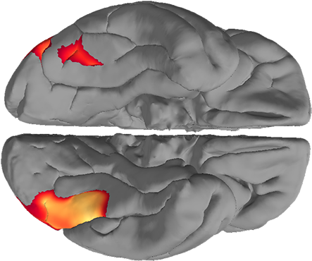 Fmri Scan Of An Average Human Brain - Skull (450x394), Png Download