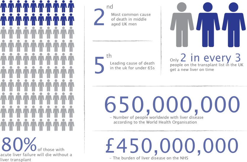 Every Year In The Uk More Than Three Thousand People - Liver Transplant Infographic Uk (898x600), Png Download