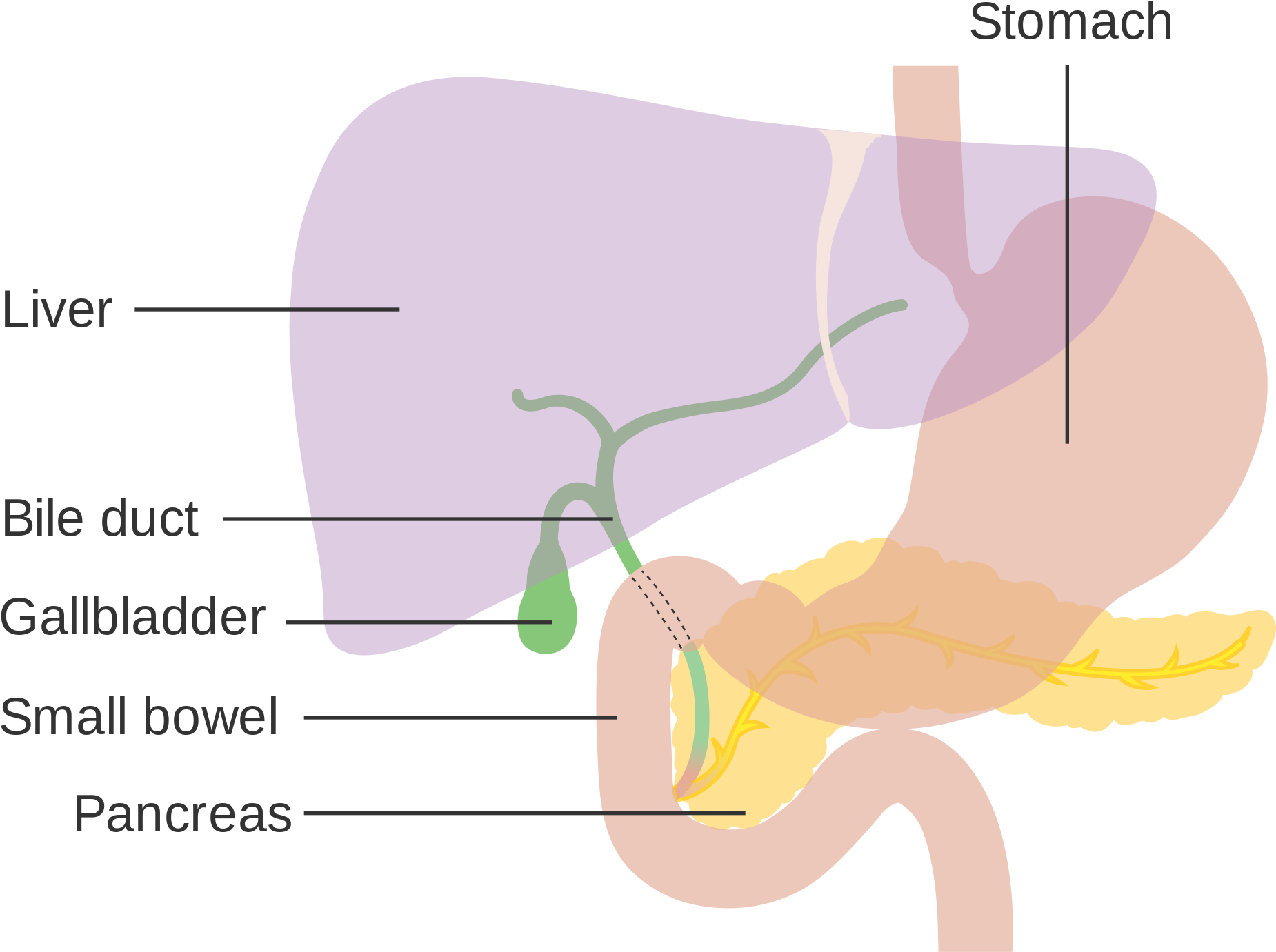 Open - Advanced Pancreatic Cancer Of The Neuroendocrine Type (2000x1648), Png Download