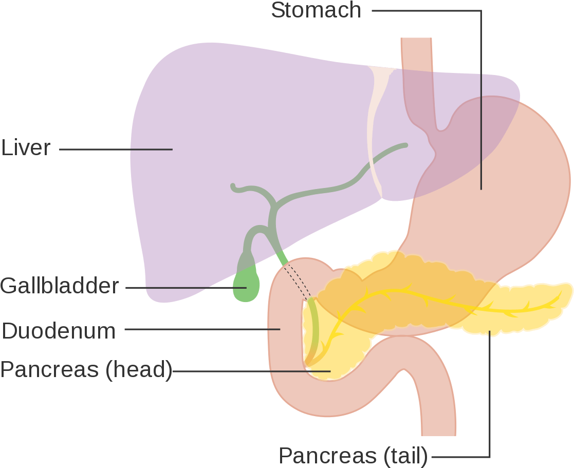 Dog Liver Cancer Diagram - Advanced Pancreatic Cancer Of The Neuroendocrine Type (1200x1085), Png Download