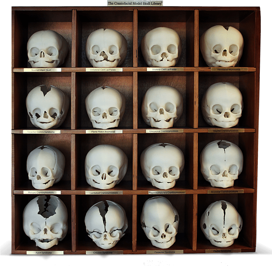 3d Systems Healthcare Craniofacial Model Skull Library - Mumbai (940x940), Png Download