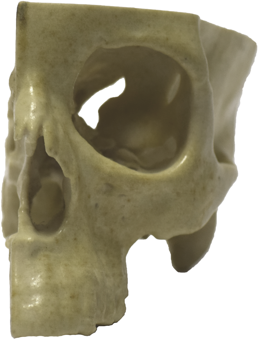 Front Of 3d Printed Half Skull - Skull (823x1080), Png Download