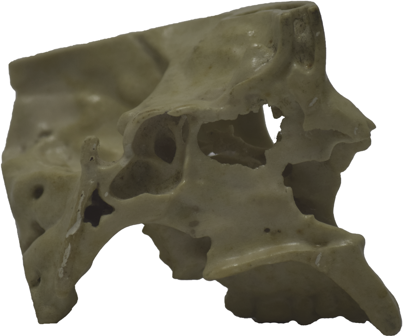 Side Of 3d Printed Half Skull - Skull (1293x1080), Png Download