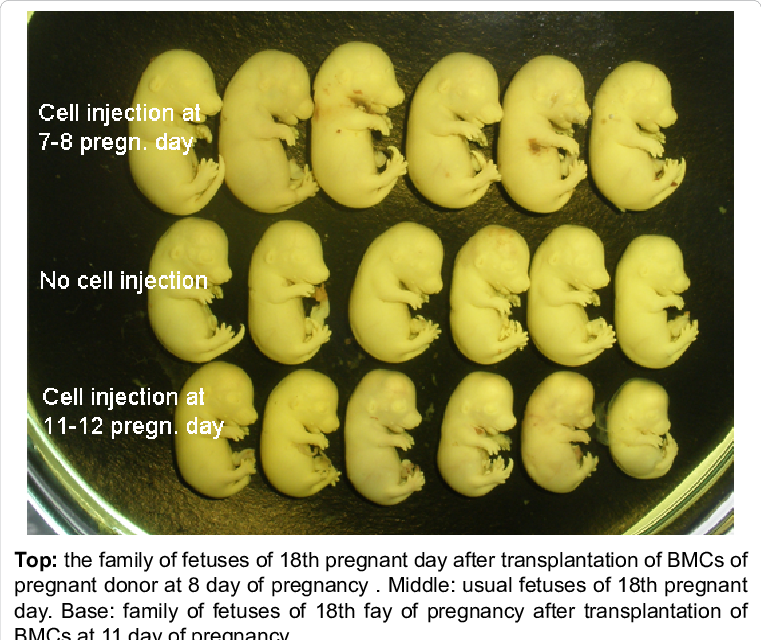 Fetuses Of 18th Day Of Pregnancy - Pregnancy (761x640), Png Download
