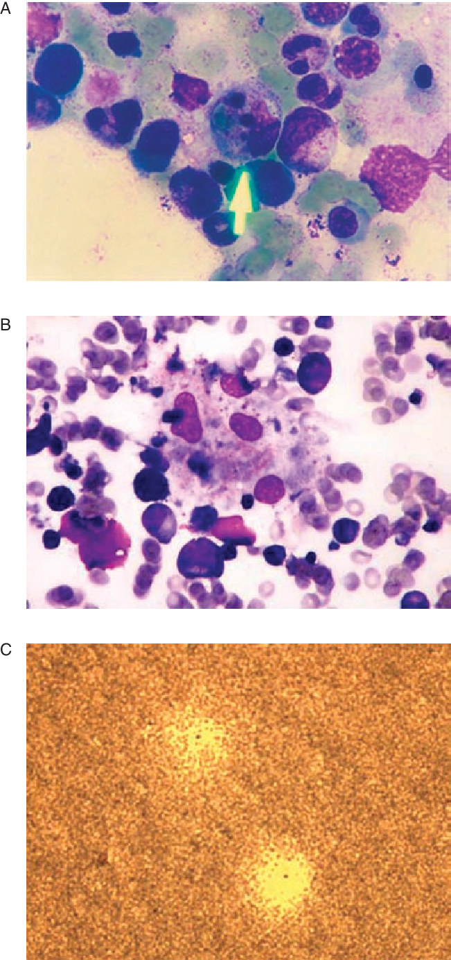 Light Microscope Image Showing Macrophages Phagocytizing - Neutrophils Phago (651x1386), Png Download