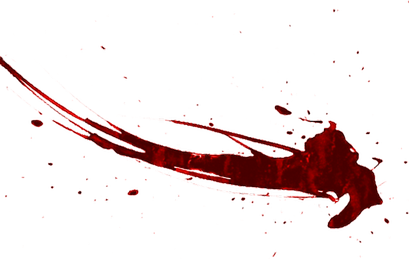 Report Abuse - Manchas De Sangre Png (798x506), Png Download
