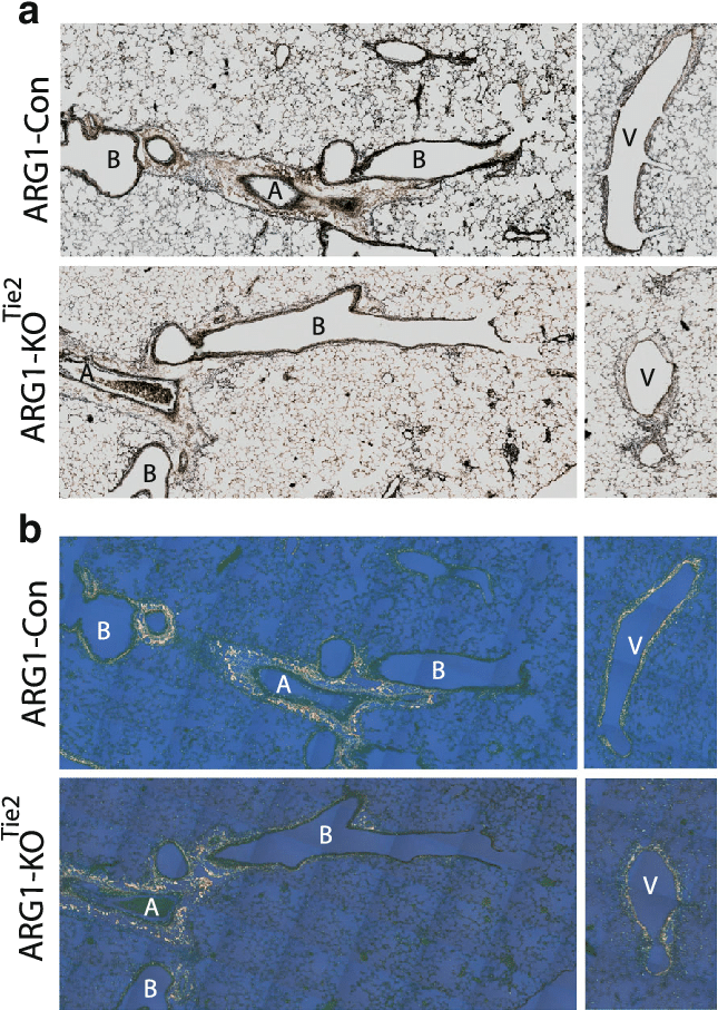 Effect Of Arg1 Ablation On Lung Remodeling - Tek Tyrosine Kinase (644x917), Png Download