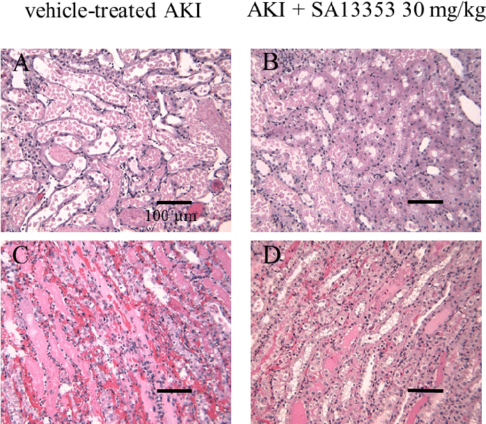 Light Microscopy Of The Outer Zone Outer Stripe And - Marble (704x616), Png Download