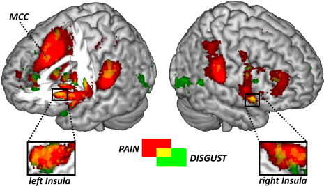 Meta-analysis - Pain Matrix Fmri (475x276), Png Download