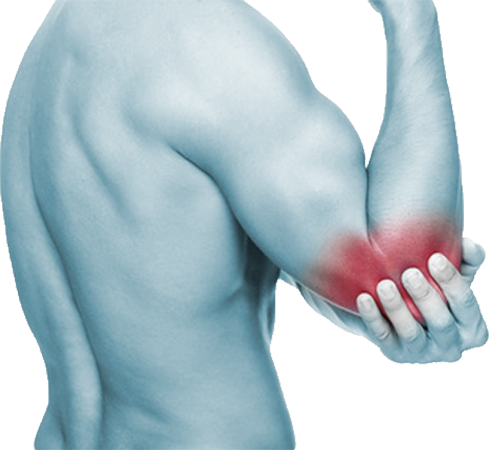 Elbow & Arm Pain - Copper Compression Copper (brown) Compression - Elbow (489x450), Png Download