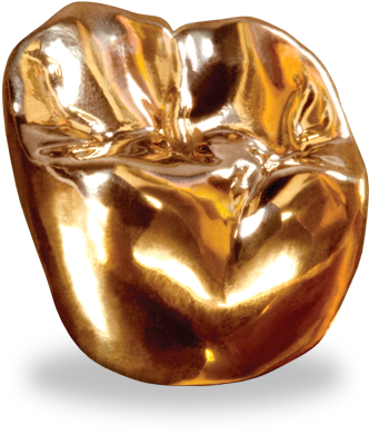 Full Cast Gold Restorations - Pfm Crown Metal Occlusal (331x400), Png Download