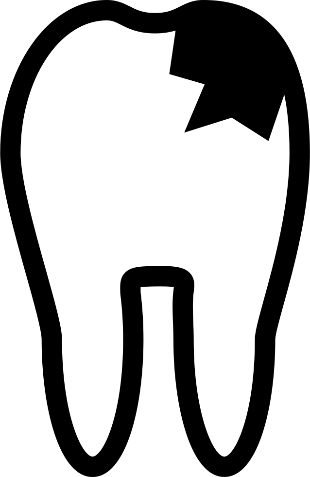 Tooth Outline With Caries - Tooth (638x980), Png Download