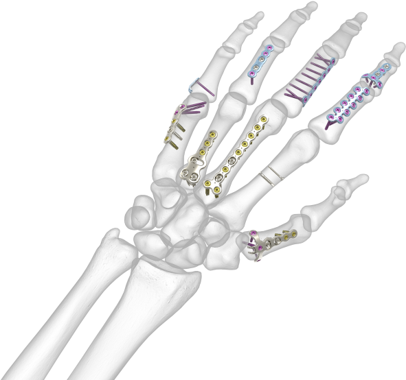 See All Images - Bone Hand (1024x576), Png Download