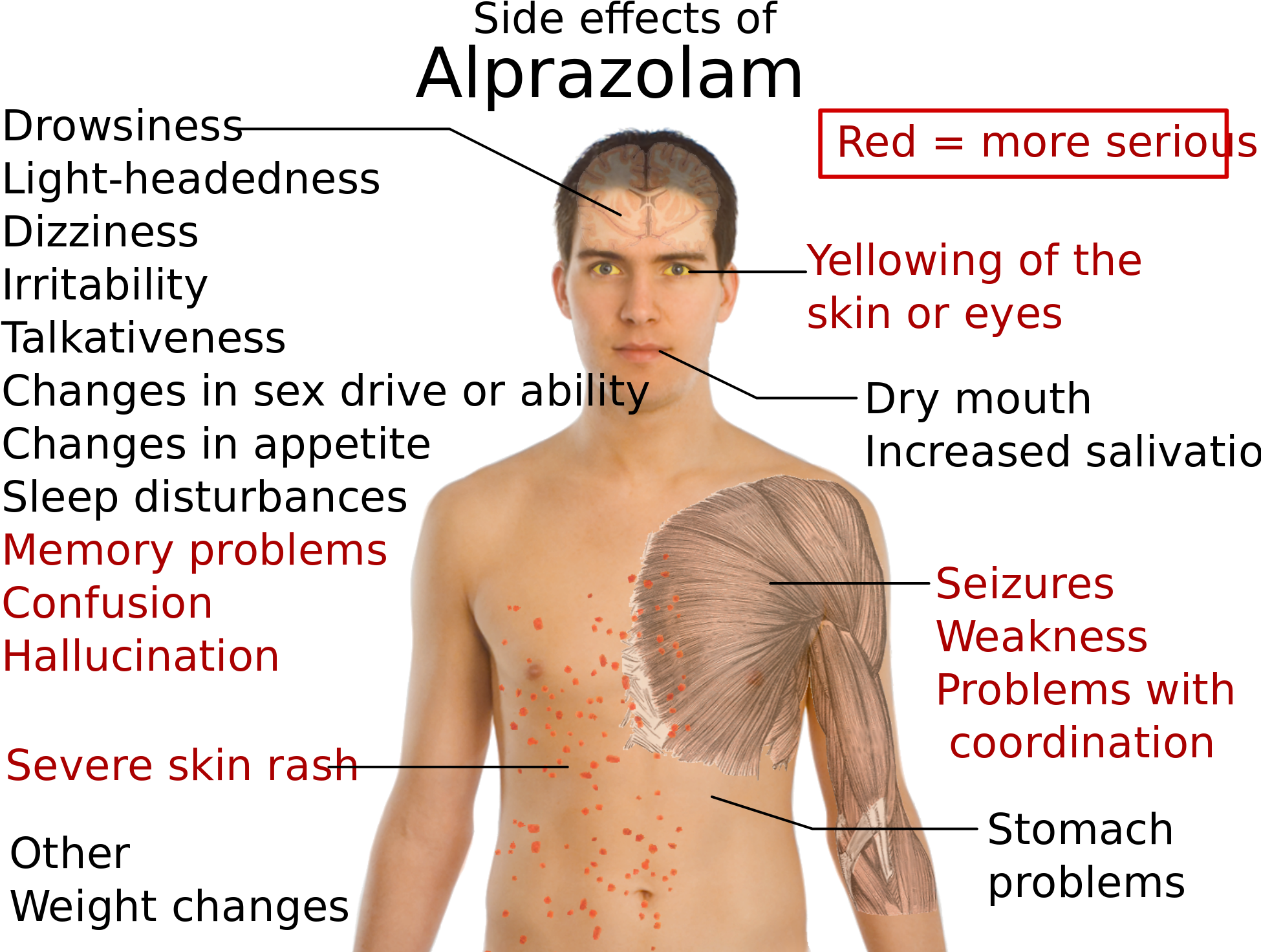 Open - Alprazolam Side Effects (2000x1492), Png Download