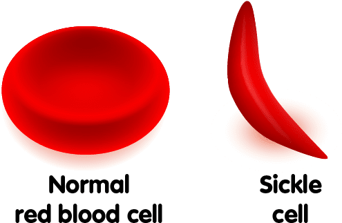 Fast Facts About African-american Blood Donation - Kansas City (494x334), Png Download