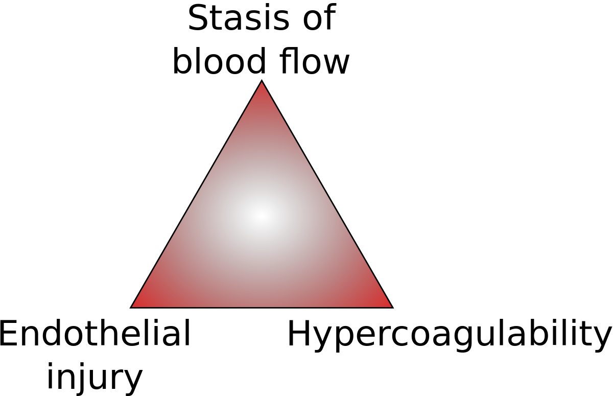 Virchow's Triad (1200x775), Png Download