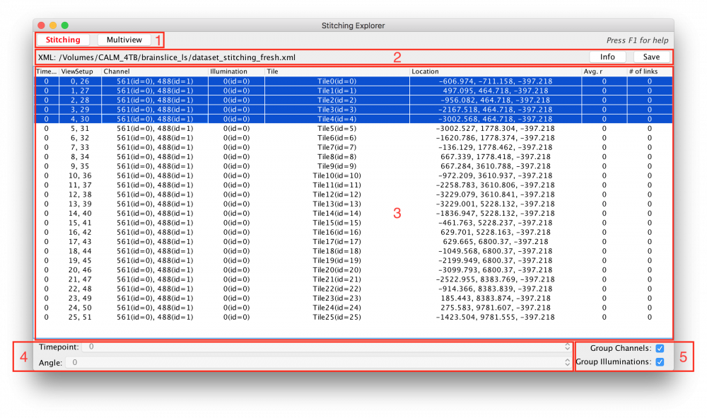 Bigstitcher Overview 1 - Portable Network Graphics (1000x591), Png Download