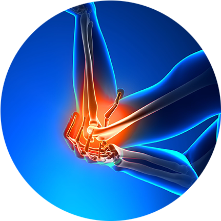 The Bicep Muscle Helps To Keep The Shoulder Steady - Elbow Pain Png (450x450), Png Download