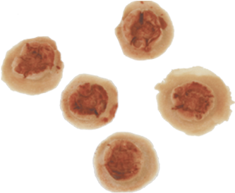 Bullet Holes 5 Pcs - Bullet Hole In Skin Png (510x600), Png Download