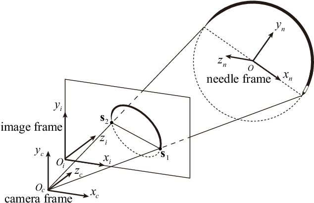 Notations Of Camera Frame Fc, Image Frame F I And Needle - Triangle (634x422), Png Download