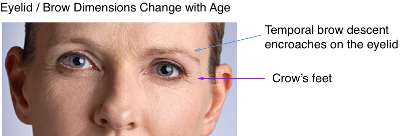 Brow Lift - Forehead Lift (798x273), Png Download