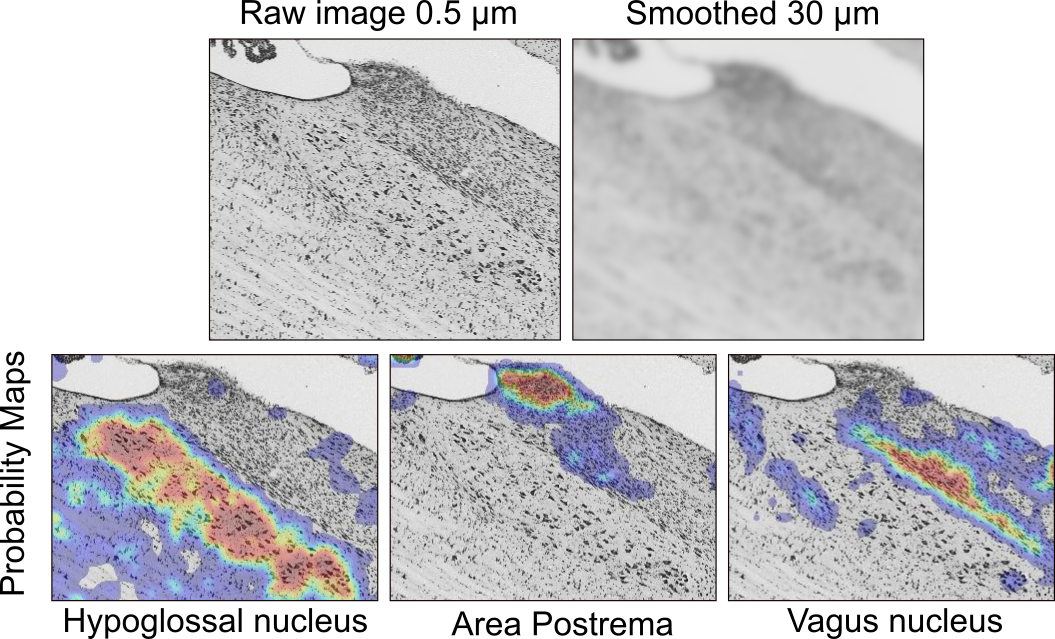 Based On Automated Registration Of Twelve Specimens, - Map (1055x639), Png Download