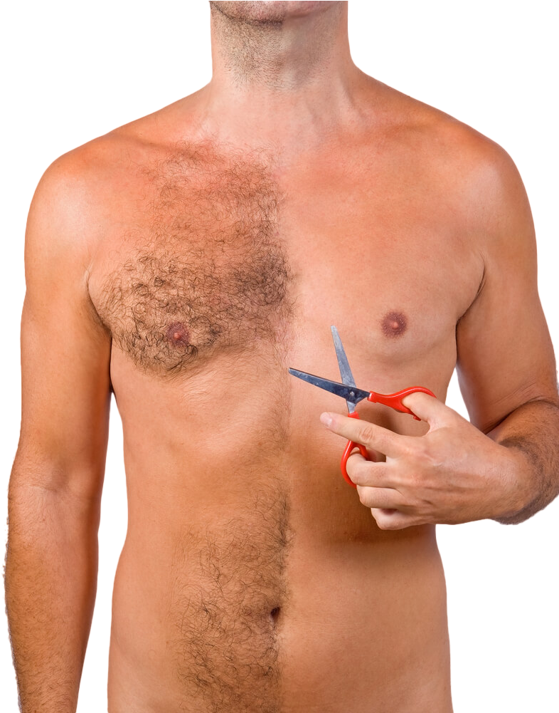 Body Hair Transplant In India - Hair Transplantation (809x1000), Png Download