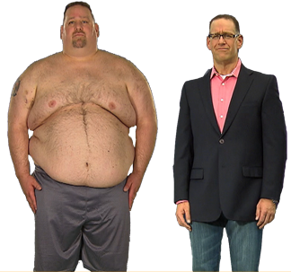 Extreme Weight Loss Is Looking For Candidates In Dallas - Herbalife Weight Loss Indian (324x303), Png Download