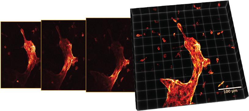 Optical Sectioning Sample - Optical Sectioning (822x370), Png Download