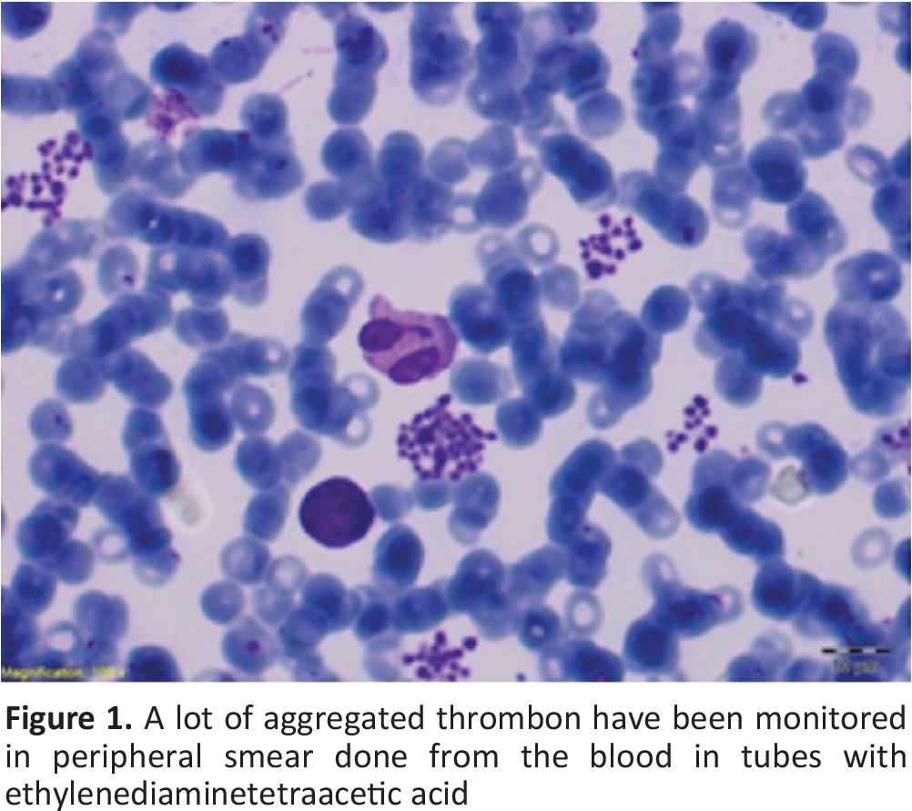 In The Patient For Whom Pseudothrombocytopenia Is Considered, - Poster (1032x907), Png Download