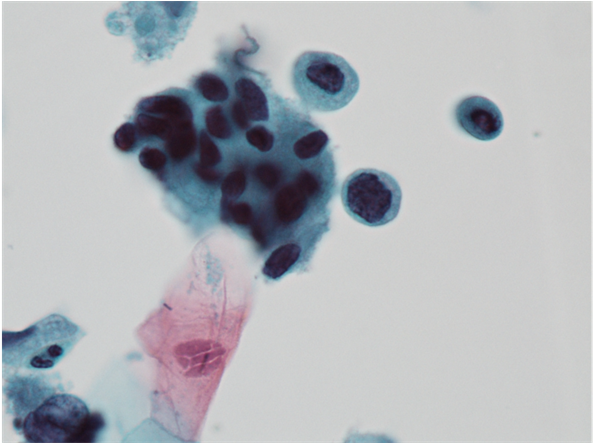 Preparation Showing Rounded Cells With Single Dyskariotic - Visual Arts (902x442), Png Download