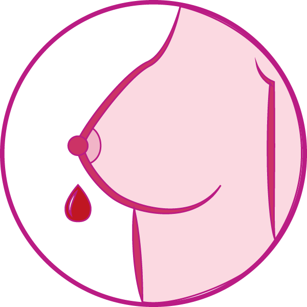 Nipple Discharge (600x600), Png Download