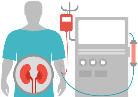 Chronic Kidney Failure - Hemodiyaliz Diyaliz (445x315), Png Download