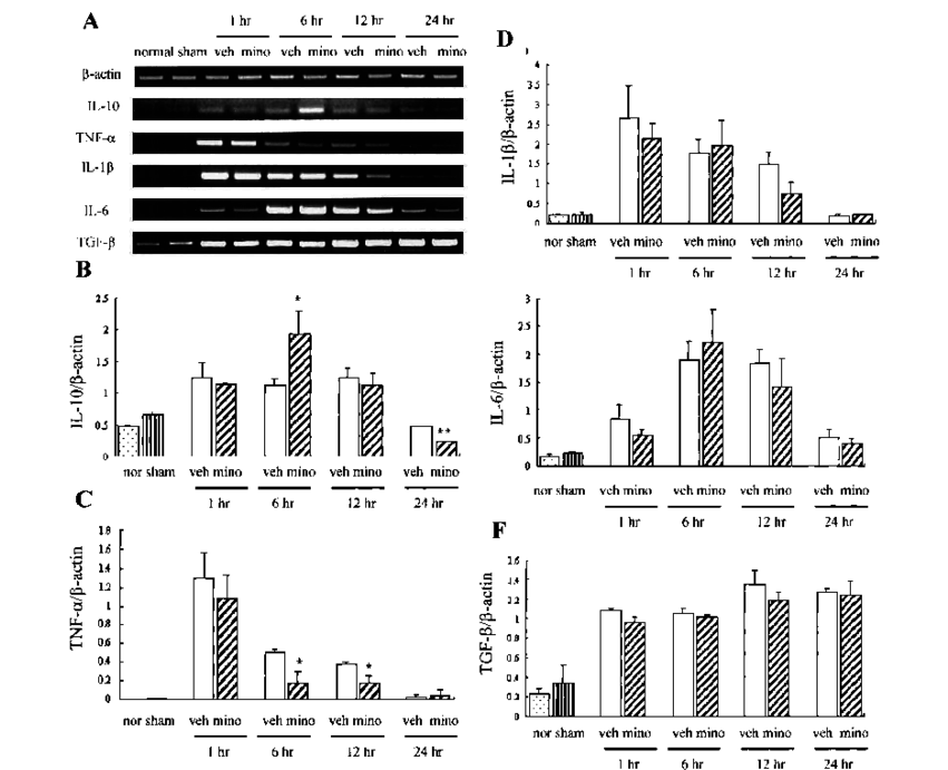 Effect Of Minocycline On Expression Of Cytokines After - Spinal Cord (850x697), Png Download