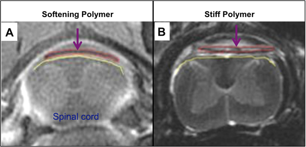 Advanced Materials For Safe And Effective Stimulation - Spinal Cord (627x301), Png Download