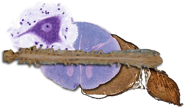 The Spinal Cord Is A Ventral Extension Of The Brainstem - Pyrrharctia Isabella (600x356), Png Download