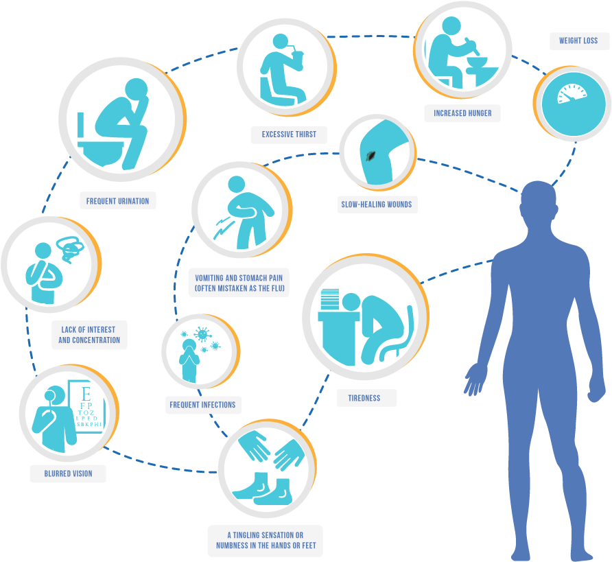 The Development Of Type 1 Diabetes Is Usually Sudden - Signs And Symptoms Of Diabetes Type 2 (1200x919), Png Download