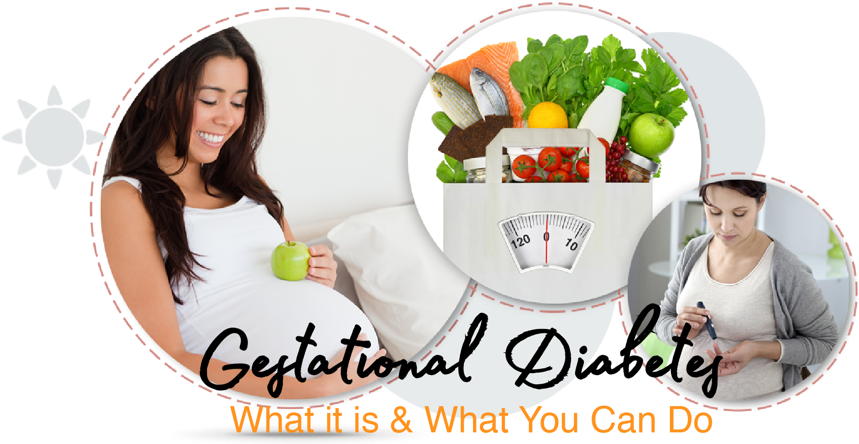 To Better Understand What Gestational Diabetes Is It - Gestational Diabetes Png (1800x935), Png Download