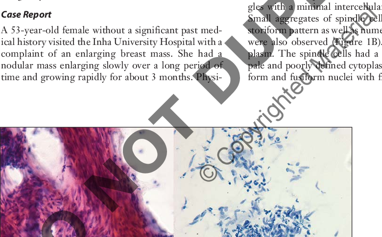 Large Tissue Fragments Display Parallel Rows Or Fascicular - Fine-needle Aspiration (780x485), Png Download